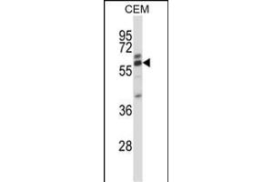 CORO2A Antibody (Center) (ABIN657512 and ABIN2846536) western blot analysis in CEM cell line lysates (35 μg/lane). (CORO2A anticorps  (AA 185-213))