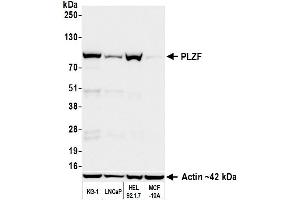 Western Blotting (WB) image for anti-Zinc Finger and BTB Domain Containing 16 (ZBTB16) (AA 6-126) antibody (ABIN7795763)
