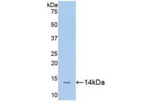 Western blot analysis of recombinant Mouse CEACAM1. (CEACAM1 anticorps  (AA 35-143))
