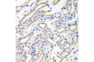 Immunohistochemistry of paraffin-embedded mouse kidney using IRAK2 antibody at dilution of 1:100 (x40 lens).