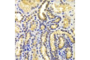 Immunohistochemistry of paraffin-embedded human kidney using EIF5A antibody.