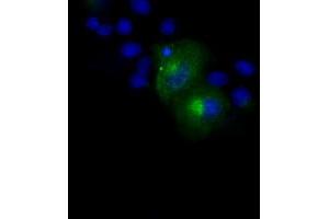 Image no. 12 for anti-Amyloid beta (A4) Precursor Protein (APP) antibody (ABIN1496877) (APP anticorps)