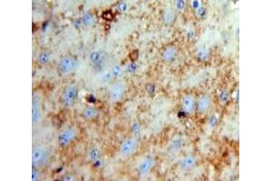 IHC-P analysis of Brain tissue, with DAB staining. (SLIT2 anticorps  (AA 1408-1519))