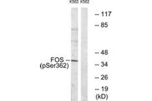 Western blot analysis of extracts from K562 cells treated with forskolin 40nM 30', using Fos (Phospho-Ser362) Antibody. (c-FOS anticorps  (pSer362))