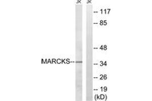 Western blot analysis of extracts from Jurkat cells, using MARCKS (Ab-158) Antibody. (MARCKS anticorps  (AA 126-175))