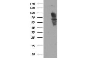 Western Blotting (WB) image for anti-SRY (Sex Determining Region Y)-Box 5 (SOX5) antibody (ABIN1501082)