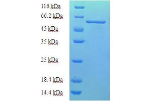 SDS-PAGE (SDS) image for AarF Domain Containing Kinase 2 (ADCK2) (AA 200-609) protein (His-SUMO Tag) (ABIN5711461)