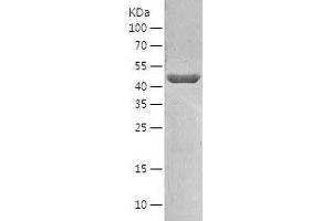 Western Blotting (WB) image for Cytohesin 2 (CYTH2) (AA 1-399) protein (His-IF2DI Tag) (ABIN7122587)