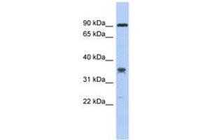 Image no. 1 for anti-Chromosome 6 Open Reading Frame 154 (C6orf154) (AA 179-228) antibody (ABIN6743771) (C6orf154 anticorps  (AA 179-228))