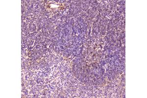 IHC analysis of CD163 using anti-CD163 antibody .