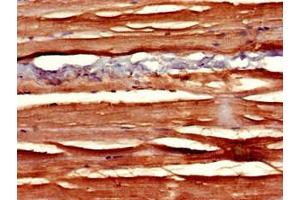 Immunohistochemistry of paraffin-embedded human skeletal muscle tissue using ABIN7169811 at dilution of 1:100 (SLIT3 anticorps  (AA 1199-1494))
