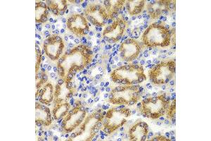 Immunohistochemistry of paraffin-embedded mouse kidney using TNFSF11 antibody at dilution of 1:100 (400x lens). (RANKL anticorps)