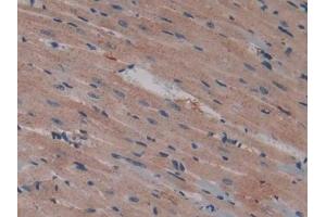 DAB staining on IHC-P; Samples: Mouse Heart Tissue (Talin anticorps  (AA 975-1181))