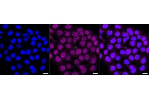 anti-Polynucleotide Kinase 3'-Phosphatase (PNKP) antibody