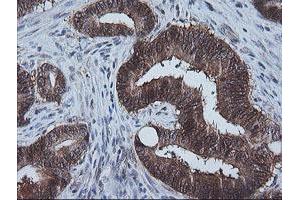 Image no. 1 for anti-Cytidine Monophosphate (UMP-CMP) Kinase 1, Cytosolic (CMPK1) antibody (ABIN1497541)