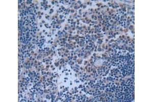 IHC-P analysis of Human Tissue, with DAB staining. (IRF5 anticorps  (AA 136-475))