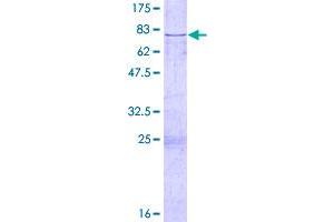 SDS-PAGE (SDS) image for Complement Factor H (CFH) (AA 1-449) protein (GST tag) (ABIN1779536)