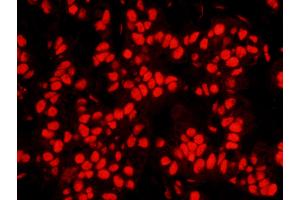 Immunofluorescence (IF) image for anti-Nucleophosmin (Nucleolar phosphoprotein B23, Numatrin) (NPM1) (AA 250-294) antibody (ABIN7448992) (NPM1 anticorps  (AA 250-294))