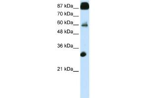 WB Suggested Anti-CTCF Antibody Titration:  0. (CTCF anticorps  (N-Term))