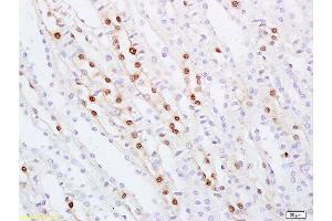 Formalin-fixed and paraffin embedded rat kidney tissue labeled with Anti ZHX2/Alpha fetoprotein regulator 1 Polyclonal Antibody, Unconjugated  at 1:100 followed by conjugation to the secondary antibody and DAB staining (ZHX2 anticorps  (AA 451-550))