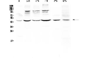Western blot analysis of DC-SIGN using anti-DC-SIGN antibody . (DC-SIGN/CD209 anticorps)