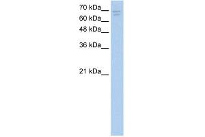 WB Suggested Anti-CACNB2 Antibody Titration:  2. (CACNB2 anticorps  (Middle Region))