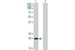 Western Blot analysis of LYPD5 expression in transfected 293T cell line by LYPD5 MaxPab polyclonal antibody. (LYPD5 anticorps  (AA 1-208))