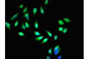 Immunofluorescent analysis of Hela cells cells using ABIN7151063 at dilution of 1:100 and Alexa Fluor 488-congugated AffiniPure Goat Anti-Rabbit IgG(H+L)