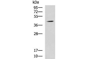 Western blot analysis of Mouse liver tissue lysate using SPI1 Polyclonal Antibody at dilution of 1:1600 (SPI1 anticorps)