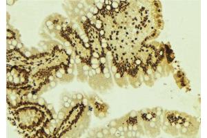 ABIN6277656 at 1/100 staining Mouse colon tissue by IHC-P. (ZEB1 anticorps  (Internal Region))