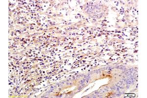 Formalin-fixed and paraffin embedded human colon labeled with Anti SLC26A4 Polyclonal Antibody, Unconjugated (ABIN721030) followed by conjugation to the secondary antibody and DAB staining (SLC26A4 anticorps  (AA 301-400))