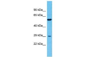 Host: Rabbit Target Name: TMPRSS11E Sample Type: Fetal Lung lysates Antibody Dilution: 1. (TMPRSS11E anticorps  (N-Term))
