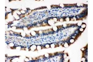 Anti- MASPIN Picoband antibody, IHC(P) IHC(P): Rat Intestine Tissue
