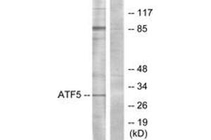 Western blot analysis of extracts from Jurkat cells, using ATF5 Antibody. (ATF5 anticorps  (AA 221-270))