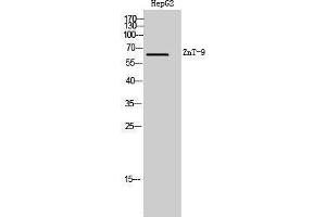 Western Blotting (WB) image for anti-Solute Carrier Family 30 (Zinc Transporter), Member 9 (SLC30A9) (Internal Region) antibody (ABIN3180952)