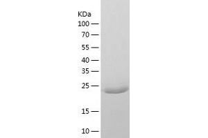 YEATS Domain Containing 4 (AA 1-227) protein (His-IF2DI Tag)