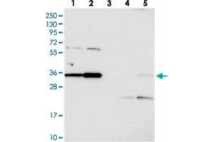 Western blot analysis of Lane 1: RT-4, Lane 2: U-251 MG, Lane 3: Human Plasma, Lane 4: Liver, Lane 5: Tonsil with C3orf26 polyclonal antibody  at 1:250-1:500 dilution. (CMSS1 anticorps)
