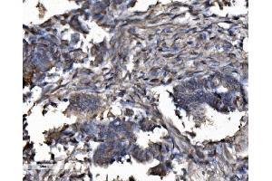 IHC analysis of DYNLL1/PIN using anti-DYNLL1/PIN antibody (ABIN7599571).