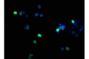 Immunofluorescence staining of HepG2 cells with ABIN7139617 at 1:100, counter-stained with DAPI. (Histone H1.5 anticorps  (pSer17))