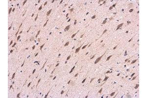 IHC-P Image APP antibody [C2C3], C-term detects APP protein at cytoplasm in Rat brain by immunohistochemical analysis. (APP anticorps  (C-Term))