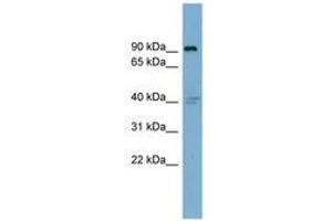 Image no. 1 for anti-Integrin beta 5 (ITGB5) (AA 395-444) antibody (ABIN6743354) (Integrin beta 5 anticorps  (AA 395-444))