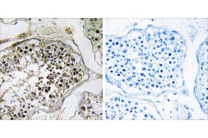 Peptide - +Immunohistochemistry analysis of paraffin-embedded human testis tissue using ELOVL2 antibody. (ELOVL2 anticorps  (Internal Region))