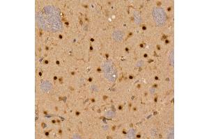 Immunohistochemistry of paraffin-embedded rat brain using C Rabbit pAb (ABIN6130035, ABIN6137891, ABIN6137892 and ABIN6220925) at dilution of 1:100 (40x lens).