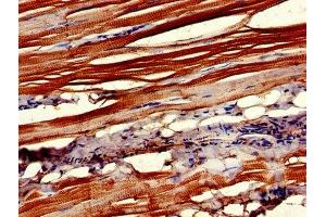 Immunohistochemistry of paraffin-embedded human skeletal muscle tissue using ABIN7147780 at dilution of 1:100