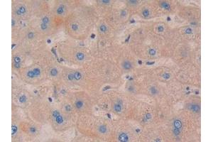 DAB staining on IHC-P; Samples: Human Liver Tissue (NOD1 anticorps  (AA 612-826))