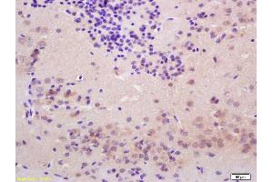 Formalin-fixed and paraffin embedded rat brain labeled with Rabbit Anti Thyroid peroxidase Polyclonal Antibody, Unconjugated (ABIN1713917) at 1:200 followed by conjugation to the secondary antibody and DAB staining (Thyroperoxidase anticorps  (AA 111-210))
