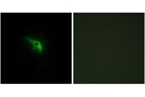 Immunofluorescence (IF) image for anti-P53-Regulated Apoptosis-Inducing Protein 1 (TP53AIP1) (AA 75-124) antibody (ABIN2890029) (TP53AIP1 anticorps  (AA 75-124))