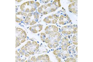 Immunohistochemistry of paraffin-embedded human stomach using TNFRSF10A antibody (ABIN5973697) at dilution of 1/100 (40x lens). (TNFRSF10A anticorps)