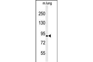 Western blot analysis of H6PD Antibody in mouse lung tissue lysates (35ug/lane) (Glucose-6-Phosphate Dehydrogenase anticorps  (C-Term))