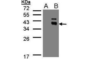 WB Image Western Blot analysis of PPM1K expression in transfected 293T cell line by PPM1K polyclonal antibody. (PPM1K anticorps)